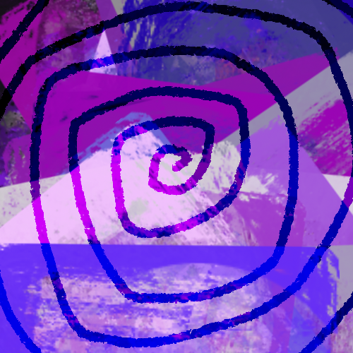 Spiral Fracture