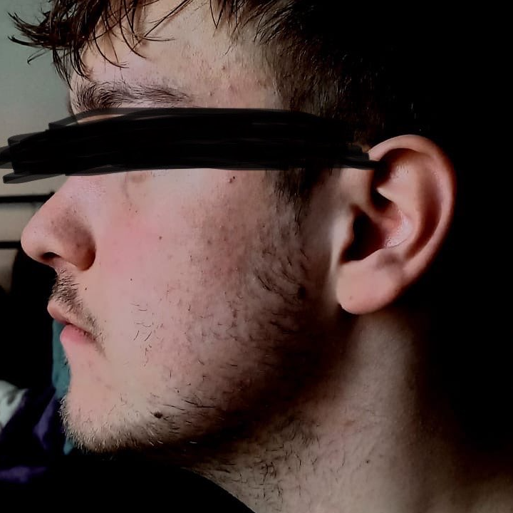 SchizoAnon