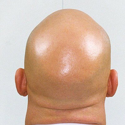 The three Baldies