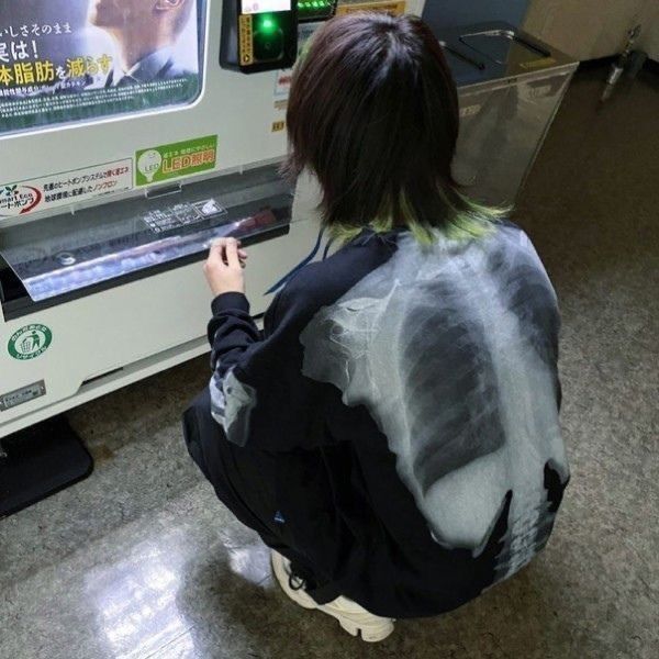 YEN